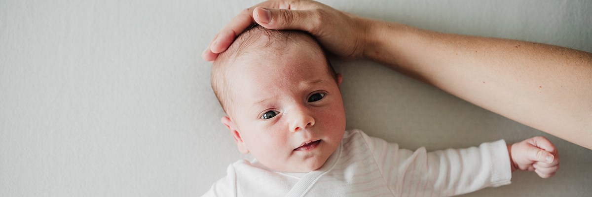 Infant Torticollis and Plagiocephaly