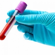 Blood Tests: How to prepare your child