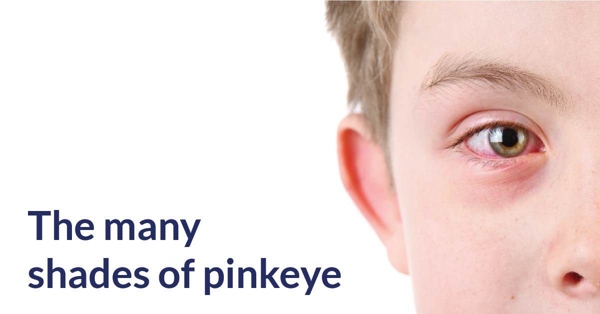 Pink clearance eye swollen